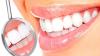Apie ką svajoja periodonto liga?