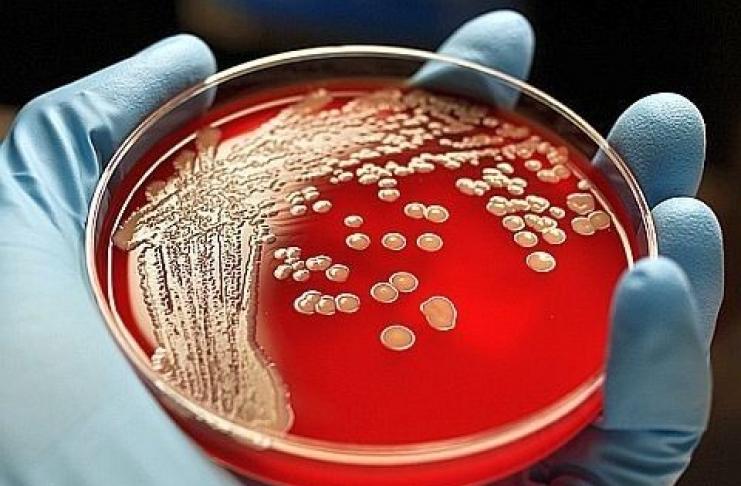 Método bacteriológico para o diagnóstico laboratorial de doenças infecciosas